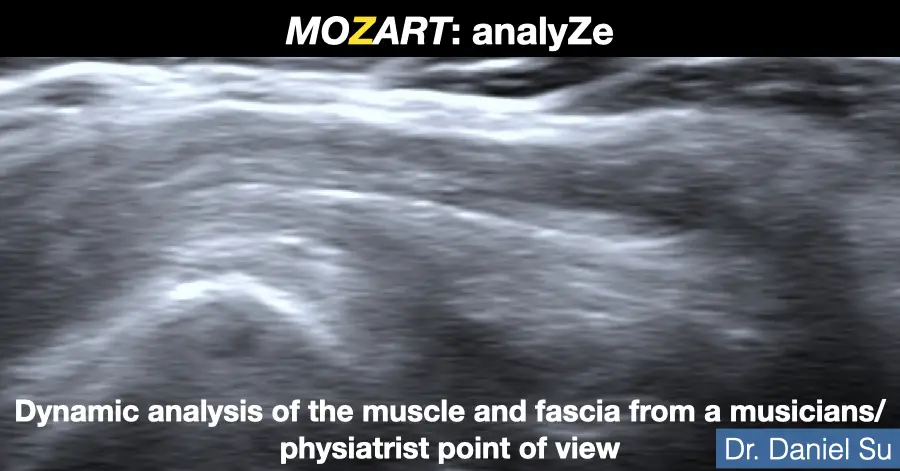 Dynamic ultrasound image of muscle and fascia during movement